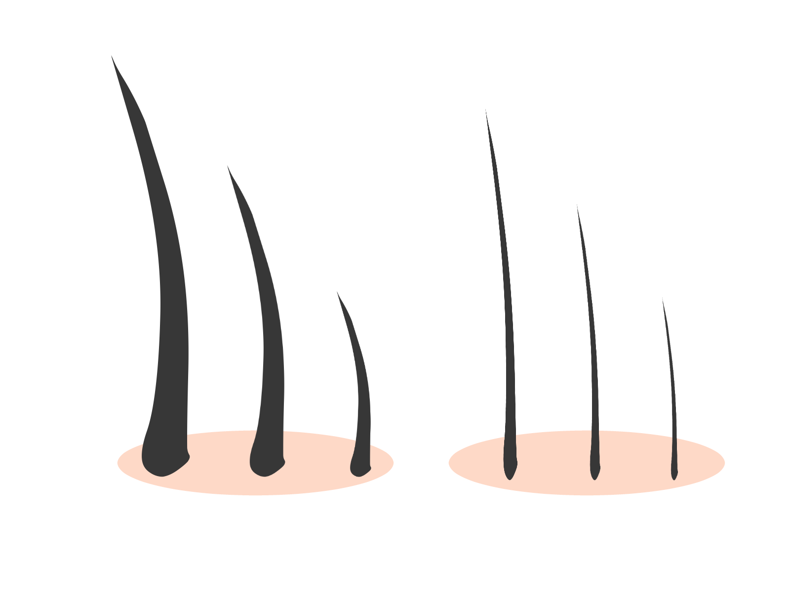 ザガーロ(デュタステリド): 薄毛・抜け毛への効果、副作用、飲み方、処方 – クリニック